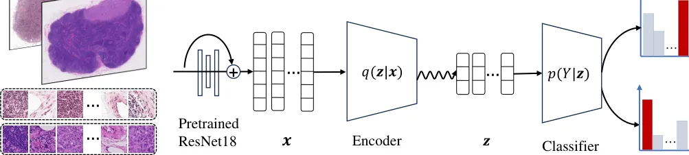 Pipeline diagram showing ResNet18 encoder-classifier method for histopathology classification