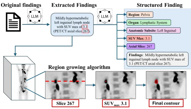 Pipeline from findings to structured extraction and region-growing segmentation